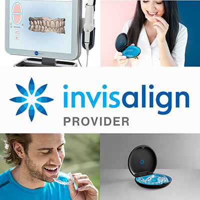 InvisAlign